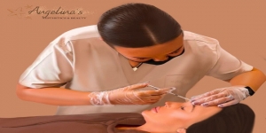 Botox glasgow